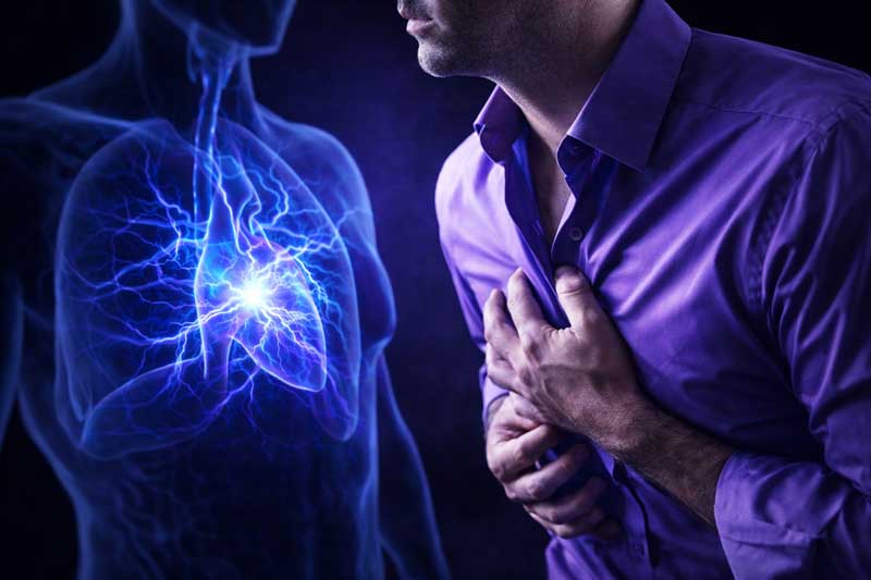 Silent Atherosclerosis